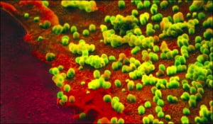 h1n1