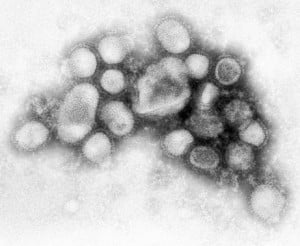 h1n1
